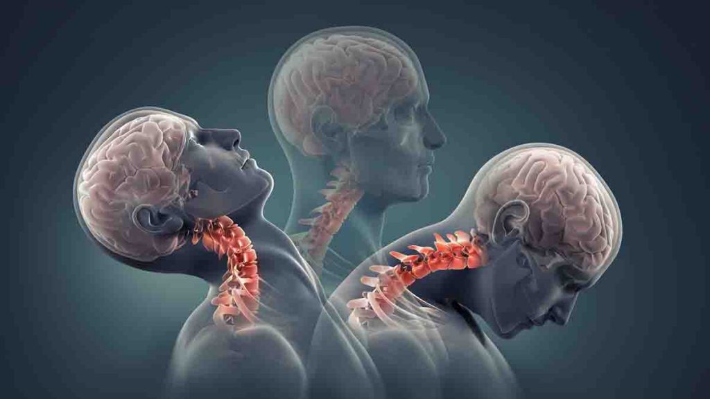 Abogados de Latigazo Cervical en Milwaukee